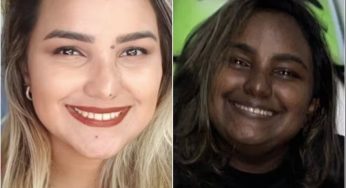 Jovem que teve mudança no tom da pele causado por tumor raro consegue remédio de R$ 32 mil